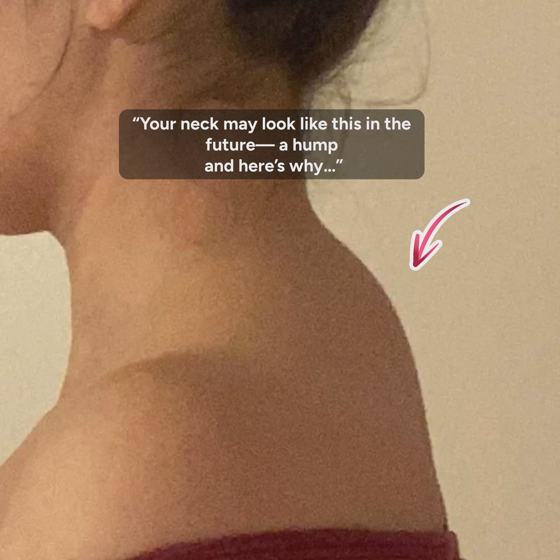 LumeShark™  Neck Cloud (Neck & Shoulder Stretcher) – Fast Relief & Muscle Release